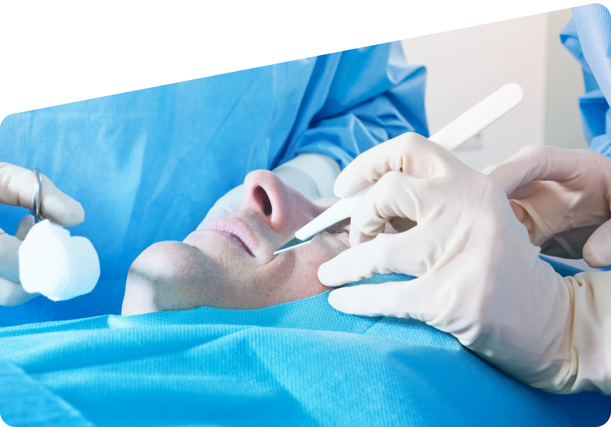 Sinus Surgery: When Is It Needed and What to Expect?