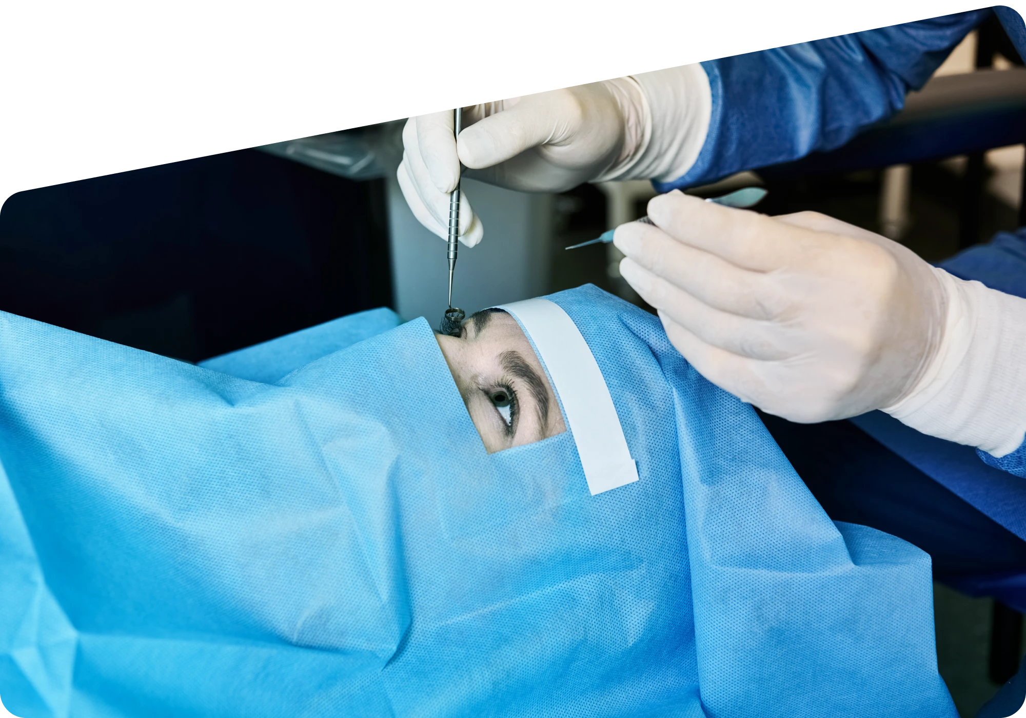 LASIK Eye Surgery Cost in the UAE: What Affects the Final Price?