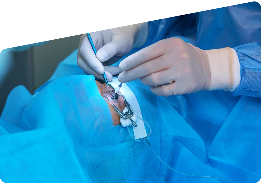 Cataract Operation Cost in UAE | Price and Insurance Guide