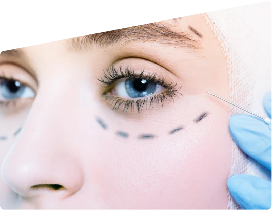 eyelid surgery dubai