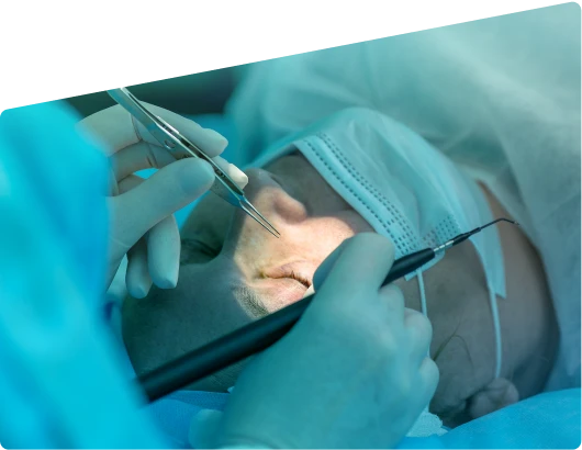 Eyelid Surgery dubai